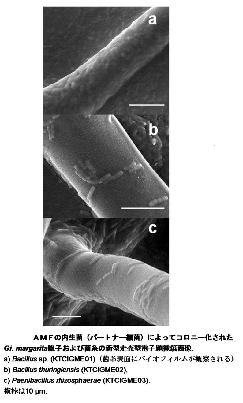 AMFの内製菌によってコロニー化された Gi. margarita胞子および菌糸の新型走査型電子顕微鏡画像